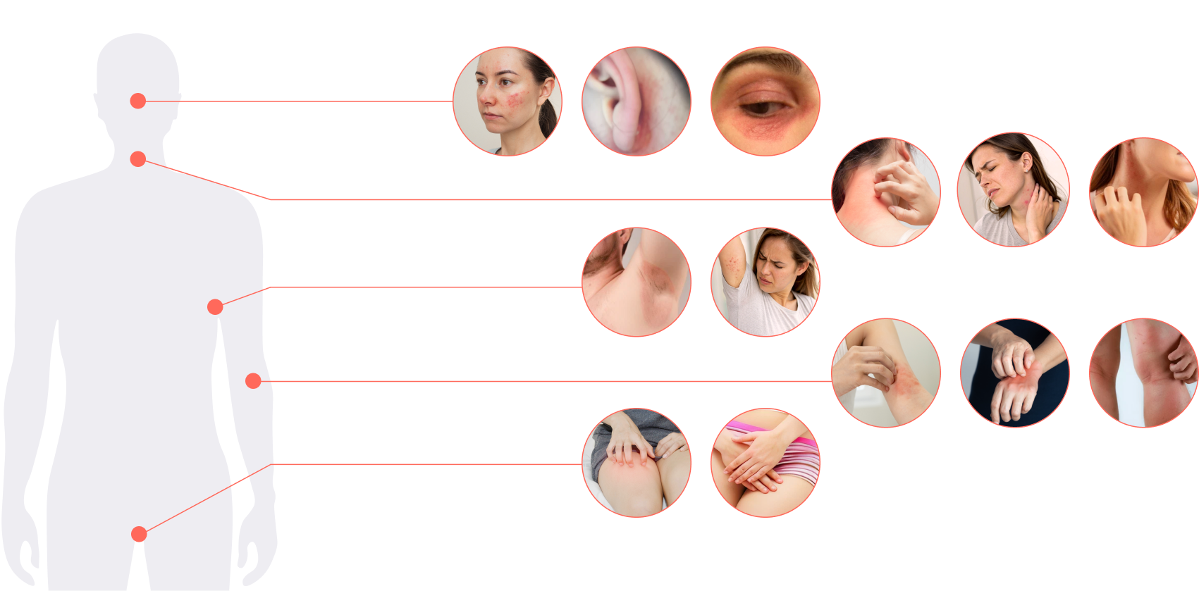 куда наносить