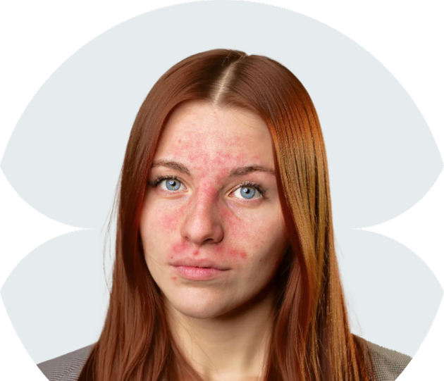 цинокап против микробов